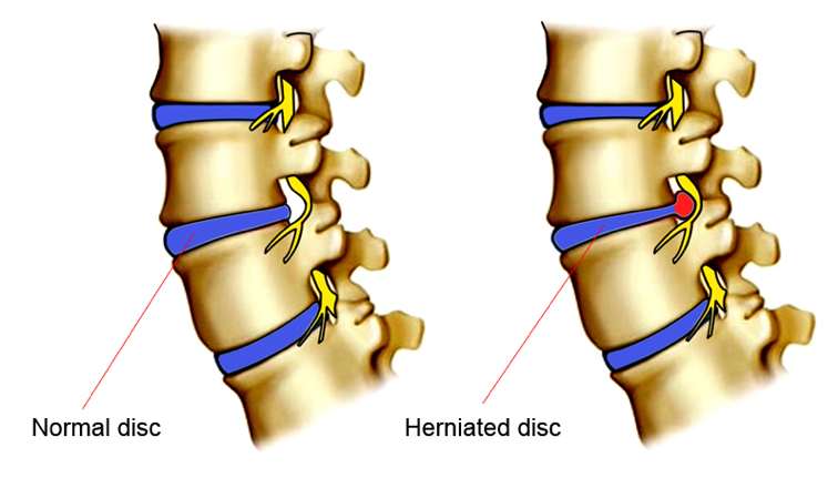 dealing-with-slip-and-fall-injuries