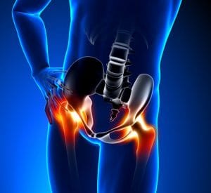 19244774 - hip pain male
